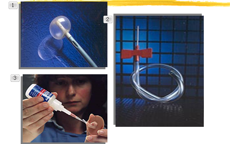 氰基丙烯酸在醫(yī)療設(shè)備上的應(yīng)用